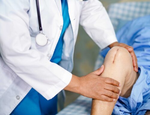 When Is Knee Replacement Surgery Necessary?