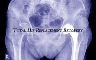 Total Hip Replacement Surgeon in Kothrud