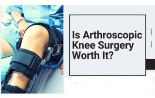 Is Arthroscopic Surgery Worth It?