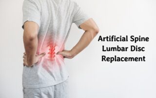 Artificial spine Lumbar Disc Replacement