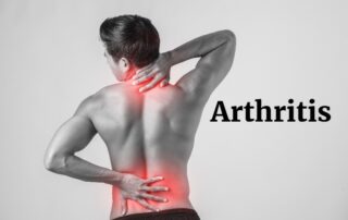 Arthritis