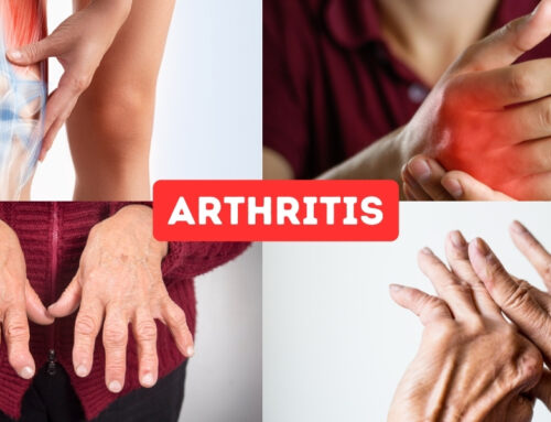 What Are 5 Vegetables To Avoid For Arthritis?