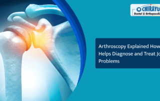 Arthroscopy Explained How It Helps Diagnose and Treat Joint Problems