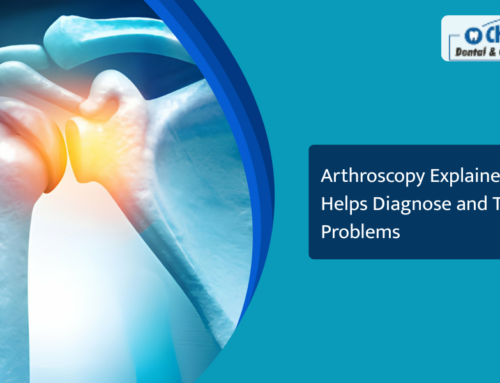 Arthroscopy Explained: How It Helps Diagnose and Treat Joint Problems