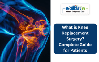 What is Knee Replacement Surgery? Complete Guide for Patients