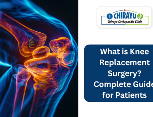 What is Knee Replacement Surgery? Complete Guide for Patients
