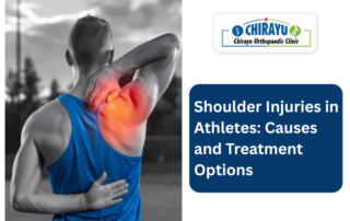 Shoulder Injuries in Athletes