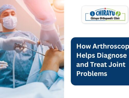 How Arthroscopy Helps Diagnose and Treat Joint Problems