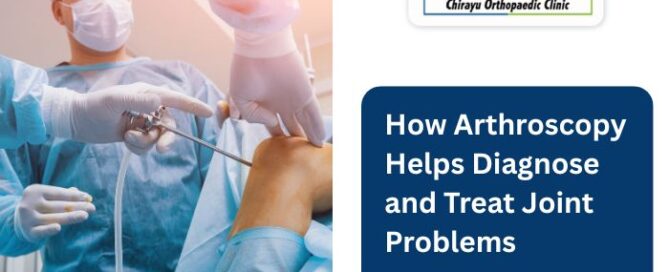 How Arthroscopy Helps Diagnose and Treat Joint Problems