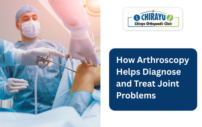 How Arthroscopy Helps Diagnose and Treat Joint Problems