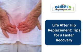 Life After Hip Replacement