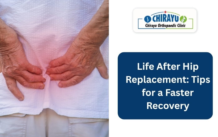 Life After Hip Replacement
