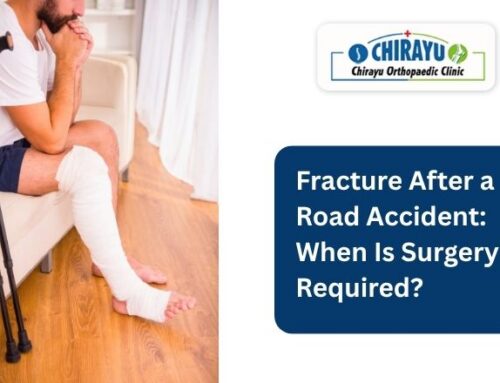 Fracture After a Road Accident: When Is Surgery Required?